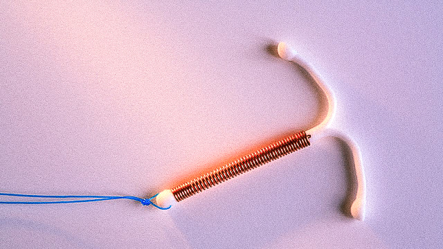 IUD contraceptive implant